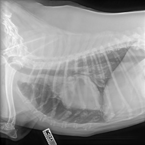 Fig 1: Abby's pneumothorax