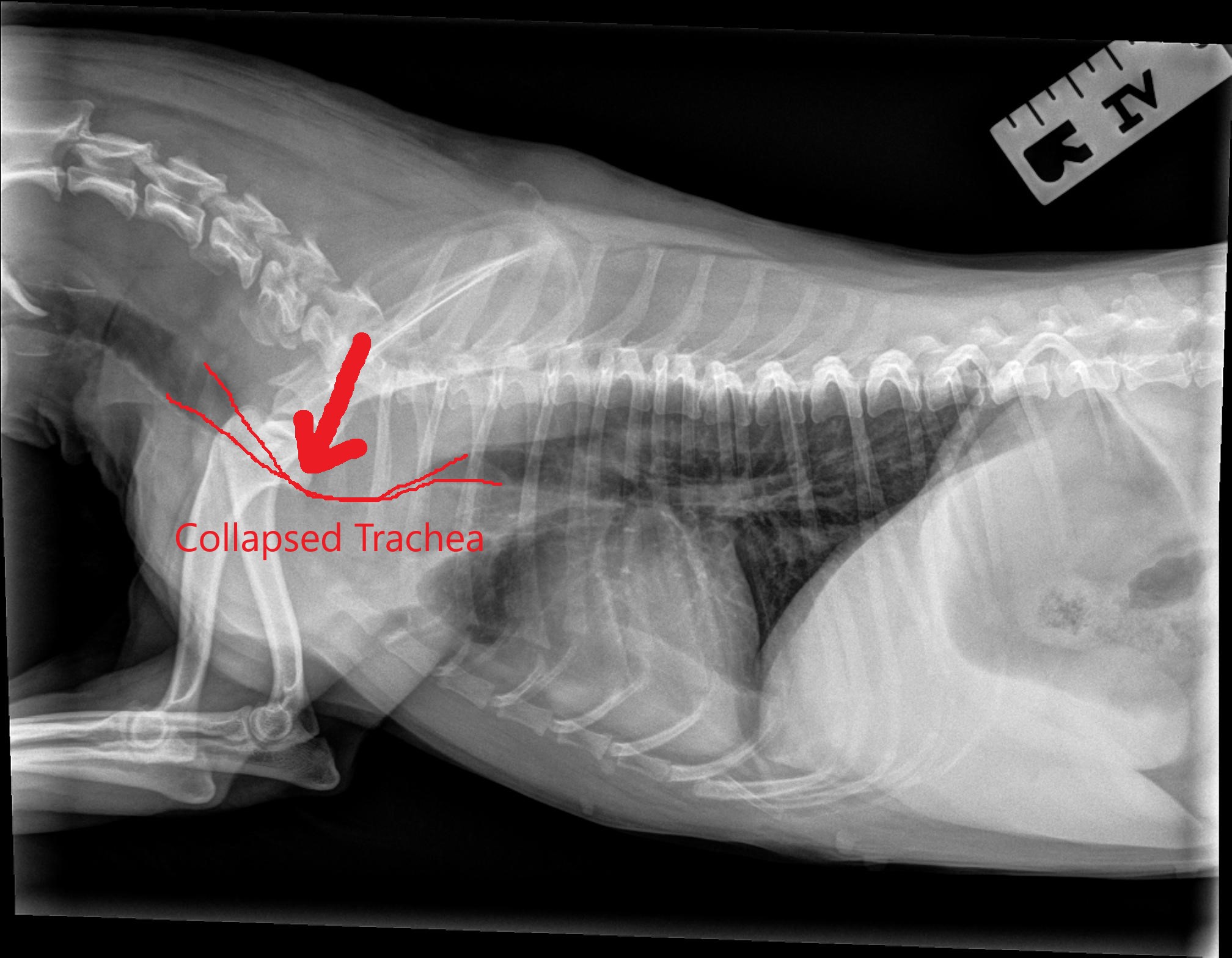 what can be done for collapsed trachea in dogs