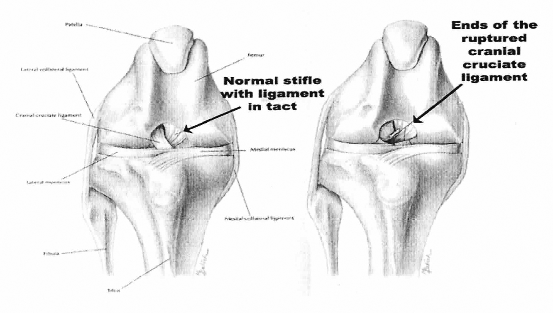 Normal and damaged stifle ligaments