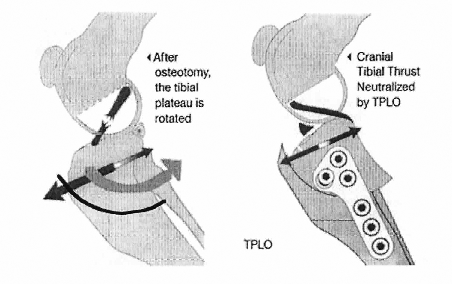 Tibial Plateau Leveling Osteotomy